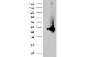 Western Blotting (WB) image for anti-Low Density Lipoprotein Receptor Adaptor Protein 1 (LDLRAP1) antibody (ABIN1496691) (LDLRAP1 抗体)