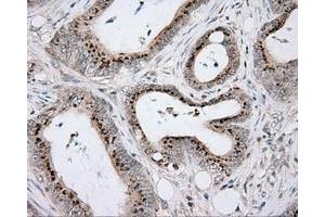 Immunohistochemical staining of paraffin-embedded Kidney tissue using anti-RC203219 mouse monoclonal antibody. (ACSBG1 抗体)