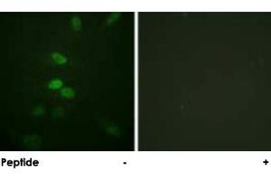 Immunofluorescence analysis of HeLa cells, using CDC25B polyclonal antibody . (CDC25B 抗体)