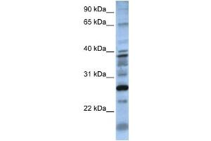 Western Blotting (WB) image for anti-Dolichyl Pyrophosphate Phosphatase 1 (DOLPP1) antibody (ABIN2459296) (DOLPP1 抗体)