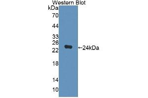 Western blot analysis of the recombinant protein. (DPEP2 抗体  (AA 303-486))