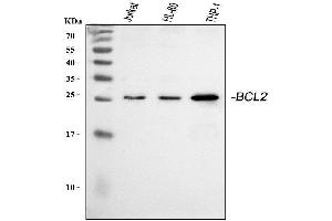 Western blot analysis of BCL2 using anti-BCL2 antibody (ABIN5693065).