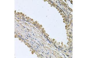 Immunohistochemistry of paraffin-embedded human prostate using MEMO1 antibody (ABIN5995855) at dilution of 1/100 (40x lens).