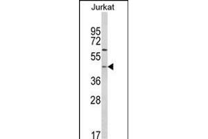 Western blot analysis of PTAR1 Antibody (Center) (ABIN652563 and ABIN2842379) in Jurkat cell line lysates (35 μg/lane). (PTAR1 抗体  (AA 60-89))