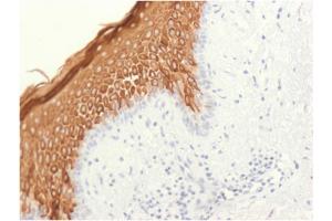 Formalin-fixed, paraffin-embedded human skin stained with Cytokeratin 10 Rabbit Recombinant Monoclonal Antibody (KRT10/1948R).