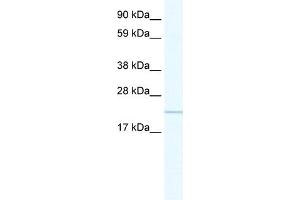 WB Suggested Anti-GTL3 Antibody Titration:  0. (C16orf80 抗体  (C-Term))