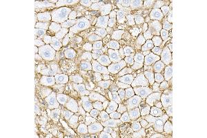Immunohistochemistry of paraffin-embedded mouse brain using RPGR Rabbit pAb (ABIN3015609, ABIN3015610, ABIN3015611, ABIN1682567 and ABIN6218971) at dilution of 1:50 (40x lens).