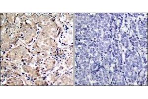 Immunohistochemistry (IHC) image for anti-Forkhead Box O1 (FOXO1) (AA 286-335), (pSer319) antibody (ABIN1531844)