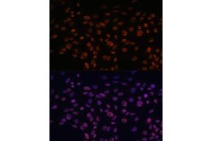 Immunofluorescence analysis of C6 cells using CHD4 antibody (ABIN6127308, ABIN6138512, ABIN6138513 and ABIN6215263) at dilution of 1:100. (CHD4 抗体  (AA 1520-1690))
