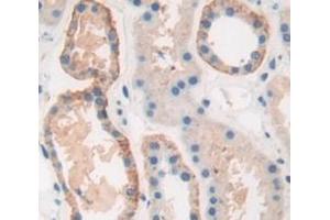 IHC-P analysis of Human Tissue, with DAB staining. (PRSS23 抗体  (AA 20-383))