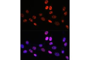 Immunofluorescence analysis of NIH-3T3 cells using P Rabbit mAb (ABIN7269445) at dilution of 1:100 (40x lens). (PABPN1 抗体)