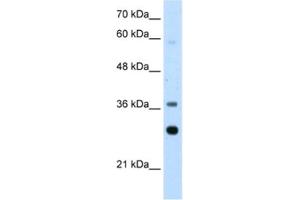 Western Blotting (WB) image for anti-Ribosomal Protein, Large, P0 (RPLP0) antibody (ABIN2462059) (RPLP0 抗体)