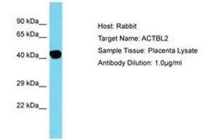 Image no. 1 for anti-Actin, beta-Like 2 (ACTBL2) (C-Term) antibody (ABIN6750797) (ACTBL2 抗体  (C-Term))