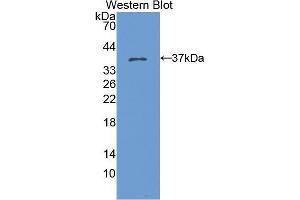 Western blot analysis of the recombinant protein. (KRT15 抗体  (AA 94-402))