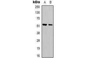 Western blot analysis of Serpin A1 expression in HepG2 (A), NIH3T3 (B) whole cell lysates. (SERPINA1 抗体  (N-Term))