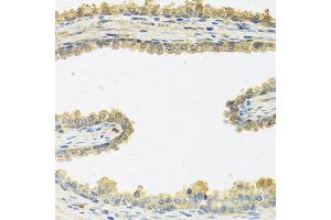 Immunohistochemistry of paraffin-embedded human prostate using CRHBP antibody at dilution of 1:100 (40x lens). (CRHBP 抗体)