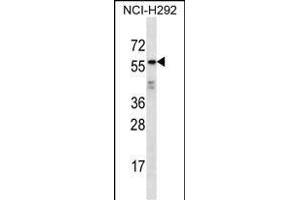 ODF2L Antibody (C-term) (ABIN656938 and ABIN2846129) western blot analysis in NCI- cell line lysates (35 μg/lane). (ODF2L 抗体  (C-Term))