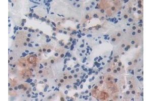 Immunohistochemistry (IHC) image for anti-Leucine Rich Repeat Containing 32 (LRRC32) (AA 162-405) antibody (ABIN7443611)