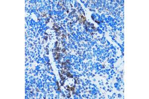 Immunohistochemistry of paraffin-embedded rat spleen using CASP3 antibody (ABIN4903140) at dilution of 1:100 (40x lens). (Caspase 3 抗体)