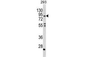 Western blot analysis of CCHCR1 Antibody (Center) in 293 cell line lysates (35ug/lane). (CCHCR1 抗体  (Middle Region))
