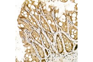 Immunohistochemistry of paraffin-embedded mouse intestin using TOPBP1 Rabbit pAb (ABIN6129493, ABIN6149398, ABIN6149401 and ABIN6221465) at dilution of 1:50 (40x lens). (TOPBP1 抗体  (AA 1253-1522))