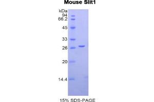 SDS-PAGE analysis of Mouse Slit Homolog 1 Protein. (SLIT1 蛋白)