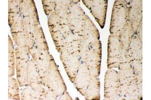 Immunohistochemistry (IHC) image for anti-ATPase, Ca++ Transporting, Cardiac Muscle, Fast Twitch 1 (ATP2A1) (N-Term) antibody (ABIN3030066)