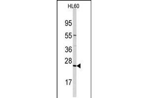 Western blot analysis of anti-TRAPPC4 Antibody in HL60 cell line lysates (35ug/lane) (TRAPPC4 抗体  (N-Term))