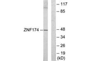 Western blot analysis of extracts from HeLa cells, using ZNF174 Antibody. (ZNF174 抗体  (AA 201-250))