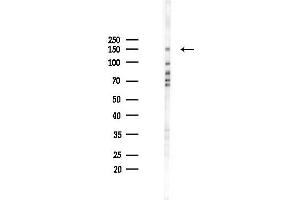 anti-Non-SMC Condensin II Complex, Subunit D3 (NCAPD3) (C-Term) antibody