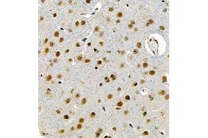 Immunohistochemistry of paraffin embedded rat brain using UBE3A (ABIN7076104) at dilution of 1:1000 (400x lens) (ube3a 抗体)