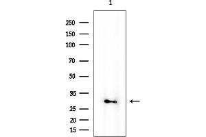 anti-Uroplakin 3A (UPK3A) antibody