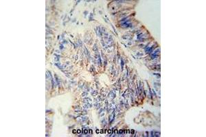 Immunohistochemistry (Paraffin-embedded Sections) (IHC (p)) image for anti-UDP-GlcNAc:betaGal beta-1,3-N-Acetylglucosaminyltransferase 6 (Core 3 Synthase) (B3GNT6) (AA 152-182), (Middle Region) antibody (ABIN950592)