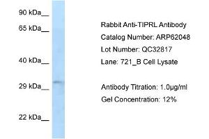 Western Blotting (WB) image for anti-TIP41-like protein (TIPRL) (N-Term) antibody (ABIN2788999) (TIPRL 抗体  (N-Term))