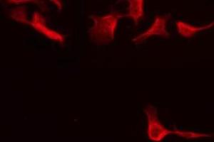 ABIN6275654 staining HeLa by IF/ICC. (Usp30 抗体  (N-Term))