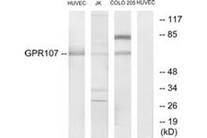 Western blot analysis of extracts from HuvEc/Jurkat/COLO205 cells, using GPR107 Antibody. (GPR107 抗体  (AA 141-190))