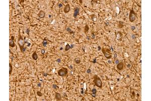 ABIN6259869 and ABIN6267009 at 1/100 staining Rat brain tissue by IHC-P. (AKT 1/2/3 抗体  (C-Term, pan))