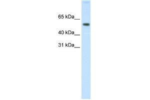 WB Suggested Anti-AKT1 Antibody Titration: 0. (AKT1 抗体  (N-Term))