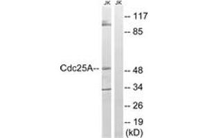 Western blot analysis of extracts from Jurkat cells, using CDC25A (Ab-178) Antibody. (CDC25A 抗体  (AA 144-193))