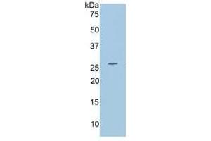 Western Blotting (WB) image for Angiopoietin 2 (ANGPT2) ELISA Kit (ABIN6730940)