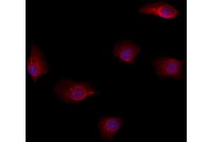 ABIN6264573 and ABIN6278624 staining Hela by IF/ICC. (RAB35 抗体  (Internal Region))