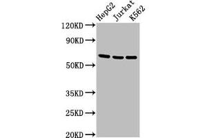 Western Blot Positive WB detected in: HepG2 whole cell lysate, Jurkat whole cell lysate, K562 whole cell lysate All lanes: TNFRSF9 antibody at 2.
