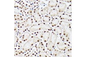 Immunohistochemistry of paraffin-embedded mouse kidney using A Rabbit pAb (ABIN6129868, ABIN6136479, ABIN6136480 and ABIN6221034) at dilution of 1:100 (40x lens). (BAF53A 抗体  (AA 1-280))