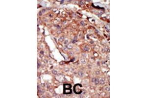 Immunohistochemistry (IHC) image for anti-Bromodomain Containing 2 (BRD2) antibody (ABIN3003651) (BRD2 抗体)