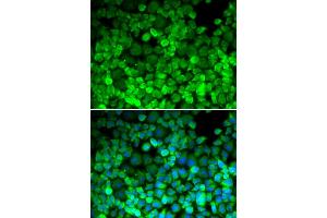 Immunofluorescence analysis of HeLa cells using TERF1 antibody. (TRF1 抗体)
