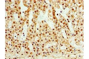 Immunohistochemistry (IHC) image for anti-TATA Box Binding Protein (TBP)-Associated Factor, RNA Polymerase I, C, 110kDa (TAF1C) (AA 70-320) antibody (ABIN7171562)