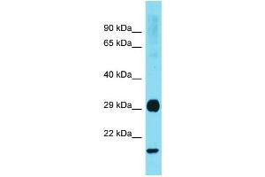 Western Blotting (WB) image for anti-RAB31, Member RAS Oncogene Family (RAB31) (Middle Region) antibody (ABIN2788973) (RAB31 抗体  (Middle Region))