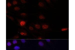 Immunofluorescence analysis of C6 cells using KLHL8 Polyclonal Antibody at dilution of 1:100. (KLHL8 抗体)