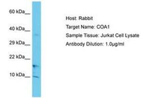 Image no. 1 for anti-UBX Domain Protein 11 (UBXN11) (C-Term) antibody (ABIN6750641) (UBXN11 抗体  (C-Term))