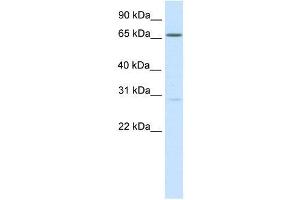 Western Blot showing NFAT5 antibody used at a concentration of 1-2 ug/ml to detect its target protein. (NFAT5 抗体  (Middle Region))